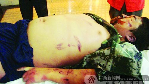 戒网瘾少年死亡校长称是感冒高烧致死